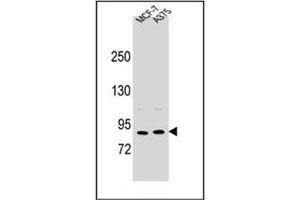 Western blot analysis of Periostin Antibody (C-term) in MCF-7, A375 cell line lysates (35ug/lane).