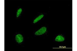 Immunofluorescence of monoclonal antibody to DBF4 on HeLa cell. (DBF4 抗体  (AA 2-98))
