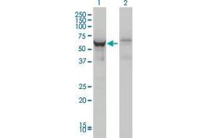 Lane 1: DDX56 transfected lysate ( 62 KDa).