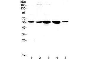 Western blot testing of human 1) placenta, 2) HeLa, 3) 22RV1, 4) SKOV and 5) A549 lysate with ETV6 antibody at 0. (ETV6 抗体)