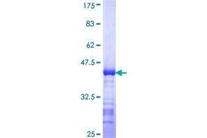 SLC39A10 Protein (AA 514-621) (GST tag)