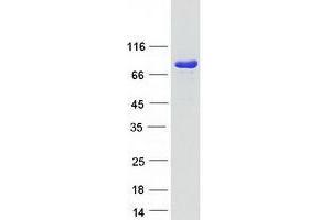 Validation with Western Blot