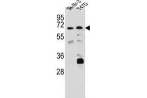 Western Blotting (WB) image for anti-Carboxylesterase 4A (CES4A) antibody (ABIN2997050) (CES4A 抗体)