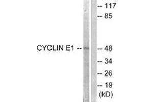 Western blot analysis of extracts from HeLa cells, treated with Paclitaxel 1uM 60', using Cyclin E1 (Ab-395) Antibody.