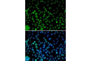 Immunofluorescence analysis of HeLa cells using IRF2 antibody.