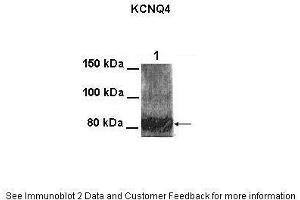 Lanes:   100 ug CHO cell lysate  Primary Antibody Dilution:   1:1000  Secondary Antibody:   Goat anti-rabbit HRP  Secondary Antibody Dilution:   1:25000  Gene Name:   KCNQ4  Submitted by:   Anonymous (KCNQ4 抗体  (Middle Region))