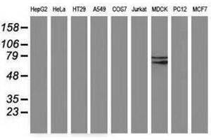 Image no. 2 for anti-Butyrylcholinesterase (BCHE) antibody (ABIN1496836) (Butyrylcholinesterase 抗体)