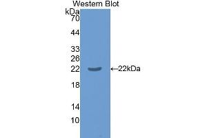 Western Blotting (WB) image for anti-Interleukin 17 Receptor B (IL17RB) (AA 166-354) antibody (ABIN1859362)