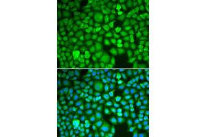 Immunofluorescence analysis of A549 cell using ETS1 antibody. (ETS1 抗体)