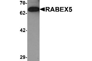 Western blot analysis of RABEX5 in rat brain tissue lysate with RABEX5 antibody at 1 µg/mL.