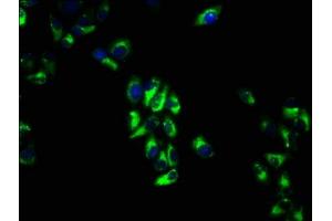 Immunofluorescence staining of Hela cells with ABIN7175204 at 1:66, counter-stained with DAPI. (VTCN1 抗体  (AA 26-258))
