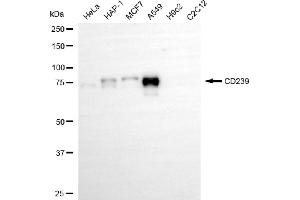Western blotting analysis using CD239 antibody (ABIN7797731). (Recombinant BCAM 抗体)