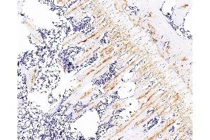 Immunohistochemistry analysis of paraffin-embedded rat bone using COL2A1 Monoclonal Antibody at dilution of 1:300. (COL2A1 抗体)