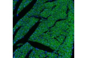 anti-Carnitine Palmitoyltransferase 1B (Muscle) (CPT1B) (AA 197-226), (N-Term) antibody