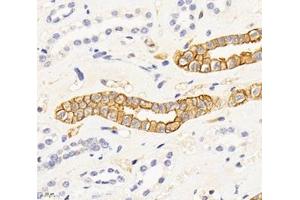 Immunohistochemistry analysis of paraffin-embedded human kidney using,SPTBN2 (ABIN7075698) at dilution of 1: 2000 (Spectrin, Beta, Non-erythrocytic 2 (SPTBN2) 抗体)