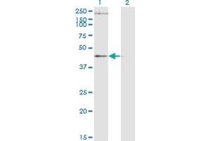 Western Blot analysis of STEAP1 expression in transfected 293T cell line by STEAP1 monoclonal antibody (M01A), clone 4F6-1F3. (STEAP1 抗体  (AA 1-339))