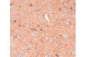 IHC-P analysis of Rat Tissue, with DAB staining. (Lymphocyte Function Associated Antigen 2 (AA 27-203) 抗体)
