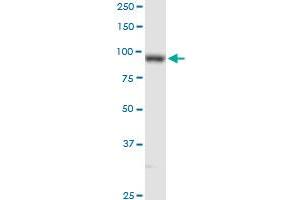 PLOD2 MaxPab rabbit polyclonal antibody. (PLOD2 抗体  (AA 1-758))