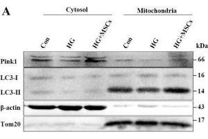 MSCs mitigate HG-induced inhibition of mitophagy through up-regulation of Pink1. (beta Actin 抗体  (AA 1-375))