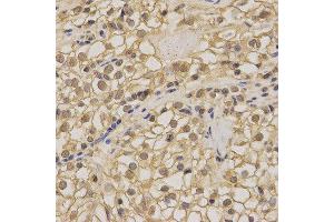 Immunohistochemistry (IHC) image for anti-Non-Metastatic Cells 1, Protein (NM23A) Expressed in (NME1) (C-Term) antibody (ABIN3020815) (NME1 抗体  (C-Term))