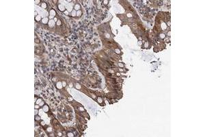 Immunohistochemical staining of human rectum with TMEM39B polyclonal antibody  shows moderate cytoplasmic and nuclear positivity in glandular cells at 1:20-1:50 dilution. (TMEM39B 抗体)
