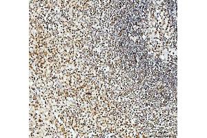 IHC analysis of SFPQ using anti-SFPQ antibody (ABIN7603089). (SFPQ 抗体  (Middle Region))