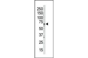 Western Blotting (WB) image for anti-G Protein-Coupled Receptor Kinase 5 (GRK5) (AA 559-590), (C-Term) antibody (ABIN390988)