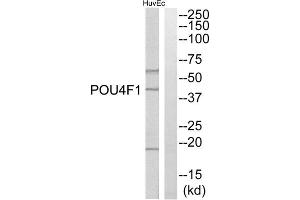 Western blot analysis of extracts from HuvEc cells, using POU4F1 antibody. (POU4F1 抗体  (Internal Region))