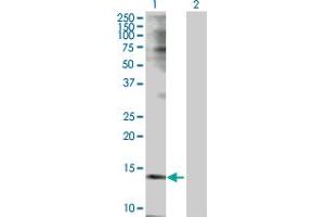 Western Blot analysis of TSPO expression in transfected 293T cell line by TSPO MaxPab polyclonal antibody. (TSPO 抗体  (AA 1-169))