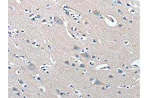 The image on the left is immunohistochemistry of paraffin-embedded Human brain tissue using ABIN7192019(PRKX Antibody) at dilution 1/15, on the right is treated with synthetic peptide. (PRKX 抗体)