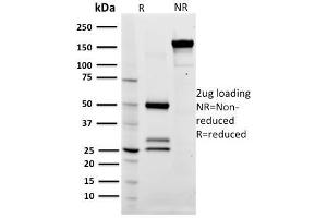 SDS-PAGE Analysis Purified CD79a Mouse Monoclonal Antibody (ZL7-4). (CD79a 抗体)