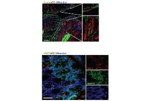 Detection of colonic tight junction proteins and heat shock proteins (HSPs) in response to Limosilactobacillus reuteri in healthy young mice. (TJP1 抗体)