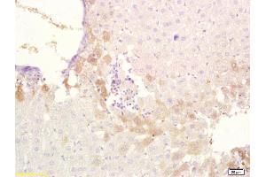 Formalin-fixed and paraffin embedded rat liver tissue labeled with Anti-ABCB6 Polyclonal Antibody, Unconjugated at 1:200, followed by conjugation to the secondary antibody and DAB staining (ABCB6 抗体  (AA 401-520))