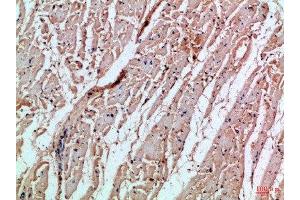 Immunohistochemical analysis of paraffin-embedded Human-heart, antibody was diluted at 1:100 (MIA 抗体  (AA 90-131))