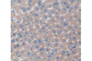 Used in DAB staining on fromalin fixed paraffin- embedded Kidney tissue (Regucalcin 抗体  (AA 1-299))