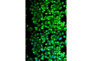 Immunofluorescence (IF) image for anti-thromboxane A Synthase 1 (Platelet) (TBXAS1) antibody (ABIN1875427) (TBXAS1 抗体)