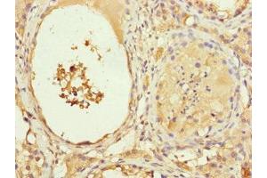 Immunohistochemistry of paraffin-embedded human testis tissue using ABIN7151076 at dilution of 1:100 (MYLIP 抗体  (AA 266-445))