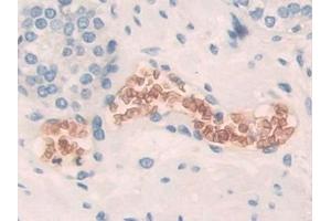 Immunohistochemistry (IHC) image for anti-Solute Carrier Family 4, Anion Exchanger, Member 1 (erythrocyte Membrane Protein Band 3, Diego Blood Group) (SLC4A1) (AA 35-290) antibody (ABIN7441895)