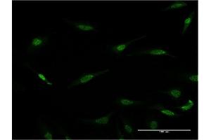Immunofluorescence of monoclonal antibody to RAX on HeLa cell. (RAX 抗体  (AA 253-346))