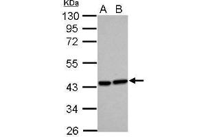 WB Image Sample (30 ug of whole cell lysate) A: HeLa B: HepG2 10% SDS PAGE antibody diluted at 1:500 (HMOX2 抗体)