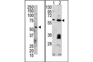 Image no. 1 for anti-Mdm2, p53 E3 Ubiquitin Protein Ligase Homolog (Mouse) (MDM2) (C-Term) antibody (ABIN356777) (MDM2 抗体  (C-Term))