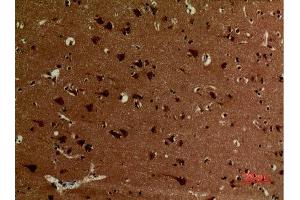 Immunohistochemistry (IHC) analysis of paraffin-embedded Human Brain, antibody was diluted at 1:100.