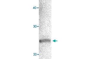 Western blot of MCF-7 cell extracts with CBX1 polyclonal antibody  at 1000 fold dilution. (CBX1 抗体  (AA 176-185))