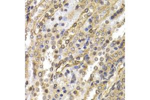 Immunohistochemistry of paraffin-embedded rat kidney using NEDD9 antibody. (NEDD9 抗体)