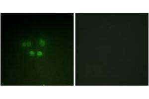 Immunofluorescence analysis of A549 cells, using Nibrin (Ab-278) Antibody. (Nibrin 抗体  (AA 251-300))