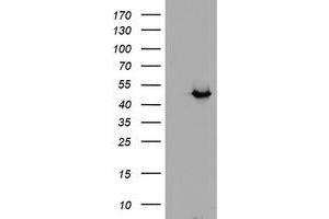 HEK293T cells were transfected with the pCMV6-ENTRY control (Left lane) or pCMV6-ENTRY ADH7 (Right lane) cDNA for 48 hrs and lysed. (ADH7 抗体)