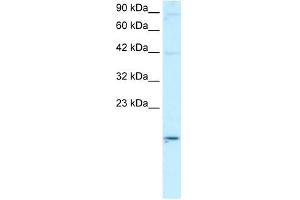 ApoBEC3G antibody used at 2 ug/ml to detect target protein. (APOBEC3G 抗体  (N-Term))