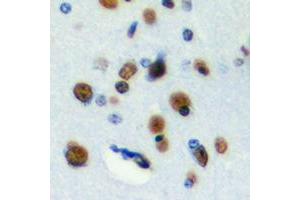 Immunohistochemical analysis of RFWD3 staining in human brain formalin fixed paraffin embedded tissue section. (RFWD3 抗体  (Center))