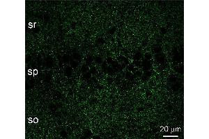 Indirect immunostaining of a PFA fixed, pepsin treated rat hippocampus section (dilution 1 : 500). (GABRB3 抗体)