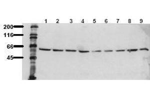 Western Blotting (WB) image for anti-V-Akt Murine Thymoma Viral Oncogene Homolog 1 (AKT1) (C-Term), (Ser473) antibody (ABIN126854) (AKT1 抗体  (C-Term, Ser473))